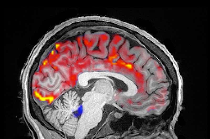 睡眠中に脳波が有害な老廃物を洗い流していることが明らかに